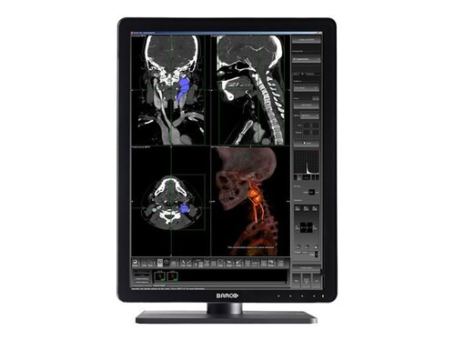 Barco K9602994 MDNC-3421 LED Monitor